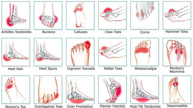 common foot problem